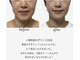 シュクラン(SHUKRAN)の写真