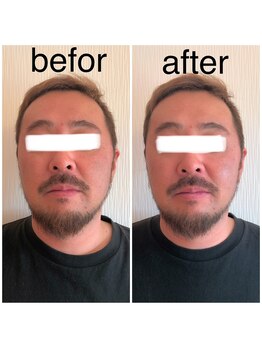 カイロプラクティック ネクサス/顔の歪み撃退☆