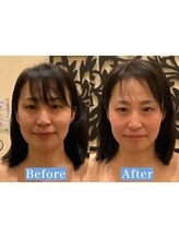 アジール 長岡リバーサイド千秋店(agir)/Before/After画像