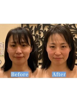 アジール 長岡リバーサイド千秋店(agir)/Before/After画像