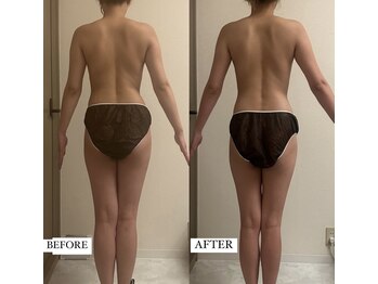 フェミニー(Feminy)/下半身の隙間がクッキリ！