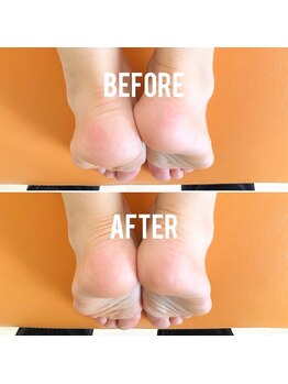 整体サロン佑/たった1回の施術で！