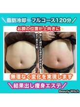 ビューティ ウィッチ(Beauty Witch)/