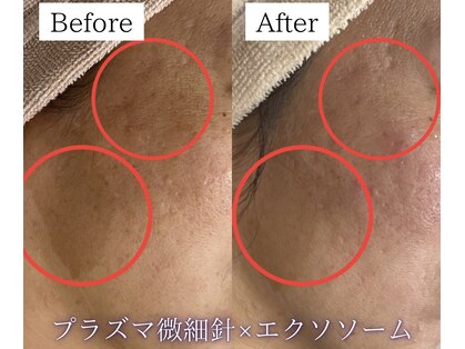 イミュ(Imyu.)の写真