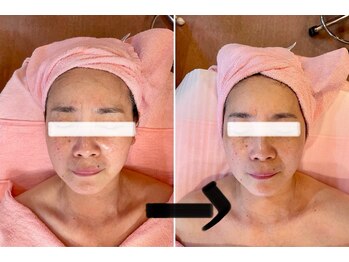 サロン ド フルール/【５０代】ビフォーアフター