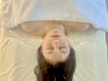 【美容鍼専門サロン】salon de Bebe.