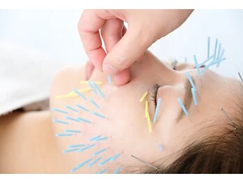 サロン ド グランツィア(salon de Granzia)/美容鍼灸で叶える美肌♪