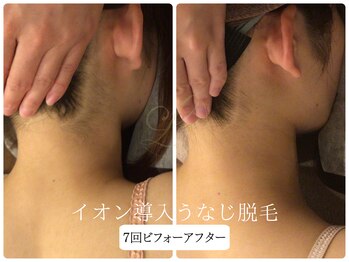 リノ(Lino)/うなじ脱毛シェービング付♪