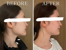 ヨサパーク ニコナ 三軒茶屋南口(YOSA PARK nicona)/短期間で集中ダイエット！！