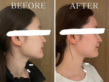 ヨサパーク ニコナ 三軒茶屋南口(YOSA PARK nicona)/短期間で集中ダイエット！！