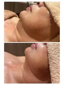 ファームディ(Pharm.D)の写真/ほうれい線・たるみケア！悩みのたるみにアプローチ！シミ、しわ、くすみへ☆コラーゲン※でハリUP♪