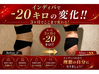 エステティック リオン(Rion)の写真