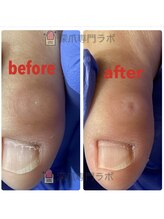 巻き爪専門ラボ 名古屋栄店/タコ・魚の目