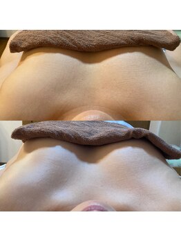 ララルアナ(Lara luana)/デコルテふっくらバストアップ