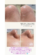 クレヴィー(Creviy)/3D毛穴洗浄×ハーブピーリング