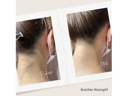 ブラジリアンワキシング シックスナイン(BrazilianWaxing69)の写真