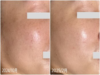 ブライトリー(Brightly)/毎月コツコツと綺麗を更新中!