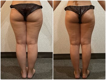 美容整体ウェリナ 名駅院/小顔矯正/骨盤矯正/美脚サロン