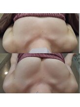 ロココ 豊田店(Rococo)/ビフォーアフター