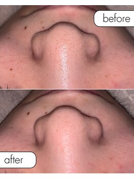 サロン ド カスケード(Salon de Cascade)/20代女性