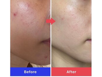 アラモア(ARAMOA)/一回で透明感ある素肌に