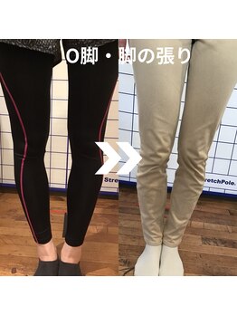 からだサロン サニー 堺東(SUNNY)/O脚・足の張り