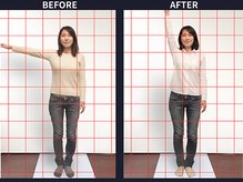 さいとう治療院 新百合ヶ丘/五十/肩/可動域制限