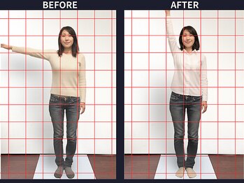 さいとう治療院 新百合ヶ丘/五十/肩/可動域制限