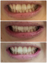 スタンド 尼崎武庫之荘店(STAND)/1ヶ月通い放題