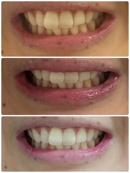 スタンド 尼崎武庫之荘店(STAND)/1ヶ月通い放題