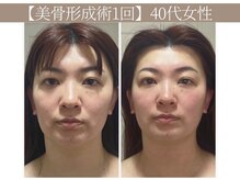 ドクターボディ 恵比寿店(Dr.Body)/【目の開き/顔のたるみ改善】
