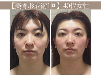 ドクターボディ 恵比寿店(Dr.Body)/【目の開き/顔のたるみ改善】