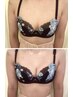 巨乳プルンッバスト施術　¥25000