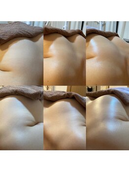 ララルアナ(Lara luana)/バストケア&ヘッドスパ