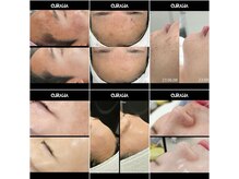 モアナ(Moana)/【結果にコミット】