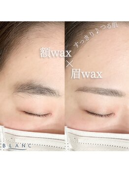 アイラッシュサロン ブラン 浜松アクトタワー店(Eyelash Salon Blanc)/おでこWAX