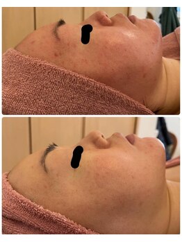 エステサロン エレガンス/