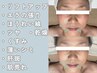 【西日本初取扱店】LDMリフティング+幹細胞培養上精液<小顔/ニキビケア/毛穴>