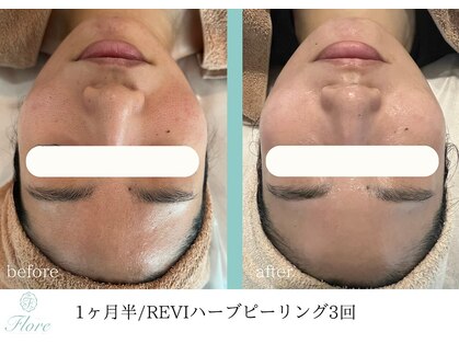 フローレ 平針店(Flore)の写真