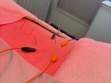 リッシュはり灸整体院