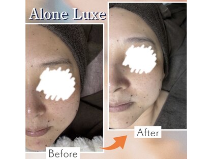 アローネリュクス(Alone Luxe)の写真