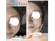 アローネリュクス(Alone Luxe)の写真