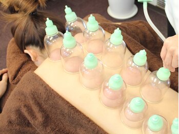 チャング ユー(CHANG YOU)/カッピング(吸玉)