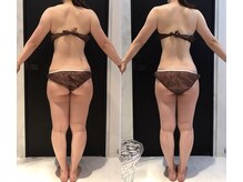 リボディ 表参道(An re Body)/before→after