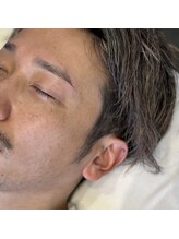 イスリーツー(ithree.2)/パラレルブロウリフト