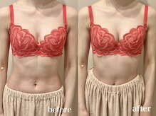 ティアモ(Ti Amo)/Before/After