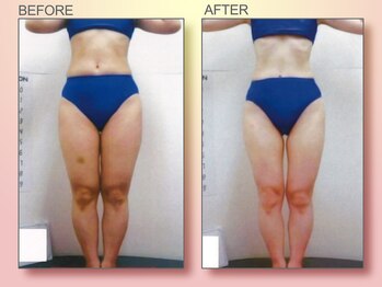 ジュリア オージェ 京橋店/ビフォーアフター(ターゲット)