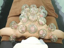 くぼみ整骨院 新大久保店/