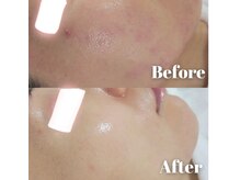 ワイグレイス(Y.GRACE)の雰囲気（【リアボーテ正規取扱店】肌質改善の実績多数★毛穴レス艶肌♪）