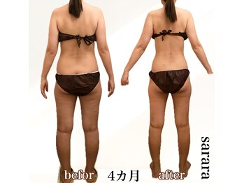 ナチュラル ビューティー スタイル さらさ(Natural Beauty Style)/さらさ痩身プログラム4カ月後